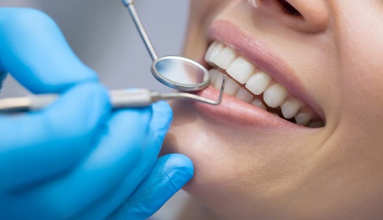 curso-de-higienista-dental