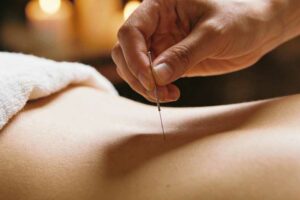 Descubre todo sobre las agujas de acupuntura: tipos, usos y claves para una práctica segura y profesional.